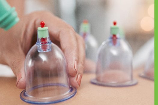 Home 3 CUPPING THERAPY